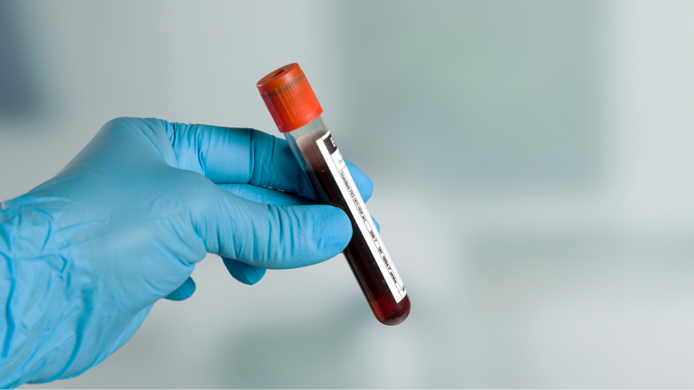 Eine behandschuhte Hand hält ein mit Blut gefülltes Probenröhrchen mit rotem Deckel. Der Hintergrund ist unscharf gehalten.