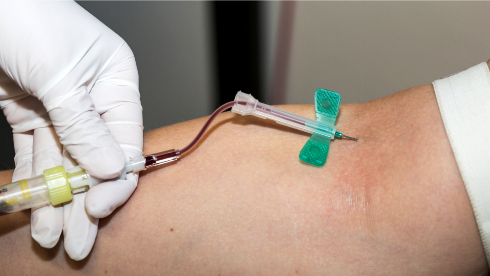 Eine Person erhält eine Blutabnahme am Arm. Eine medizinischer Fachkraft hält mit behandschuhten Händen eine Nadel mit einem Butterfly-System in eine Vene, und Blut wird über einen Schlauch in ein Probenröhrchen geleitet.