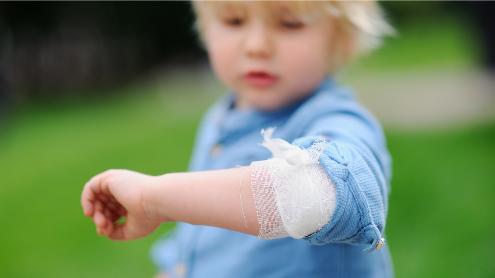 Auf dem Bild ist ein Kind zu sehen, das einen Verband am Ellenbogen trägt. Der Fokus liegt auf dem Verband, der aus weißem Mull besteht und offenbar eine Wunde oder Verletzung abdeckt. Das Kind schaut auf seinen Arm, der Ärmel ist etwas hochgekrempelt, und der Hintergrund ist unscharf, vermutlich draußen im Grünen.
