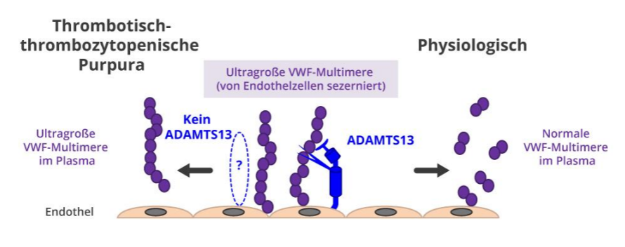 Die Grafik vergleicht die Entstehung von thrombotisch-thrombozytopenischer Purpura mit physiologischen Bedingungen. Sie zeigt, dass bei fehlendem ADAMTS13-Enzym ultragroße VWF-Multimere im Plasma verbleiben, während unter normalen Bedingungen ADAMTS13 diese Multimere spaltet und so normale VWF-Multimere im Plasma entstehen.