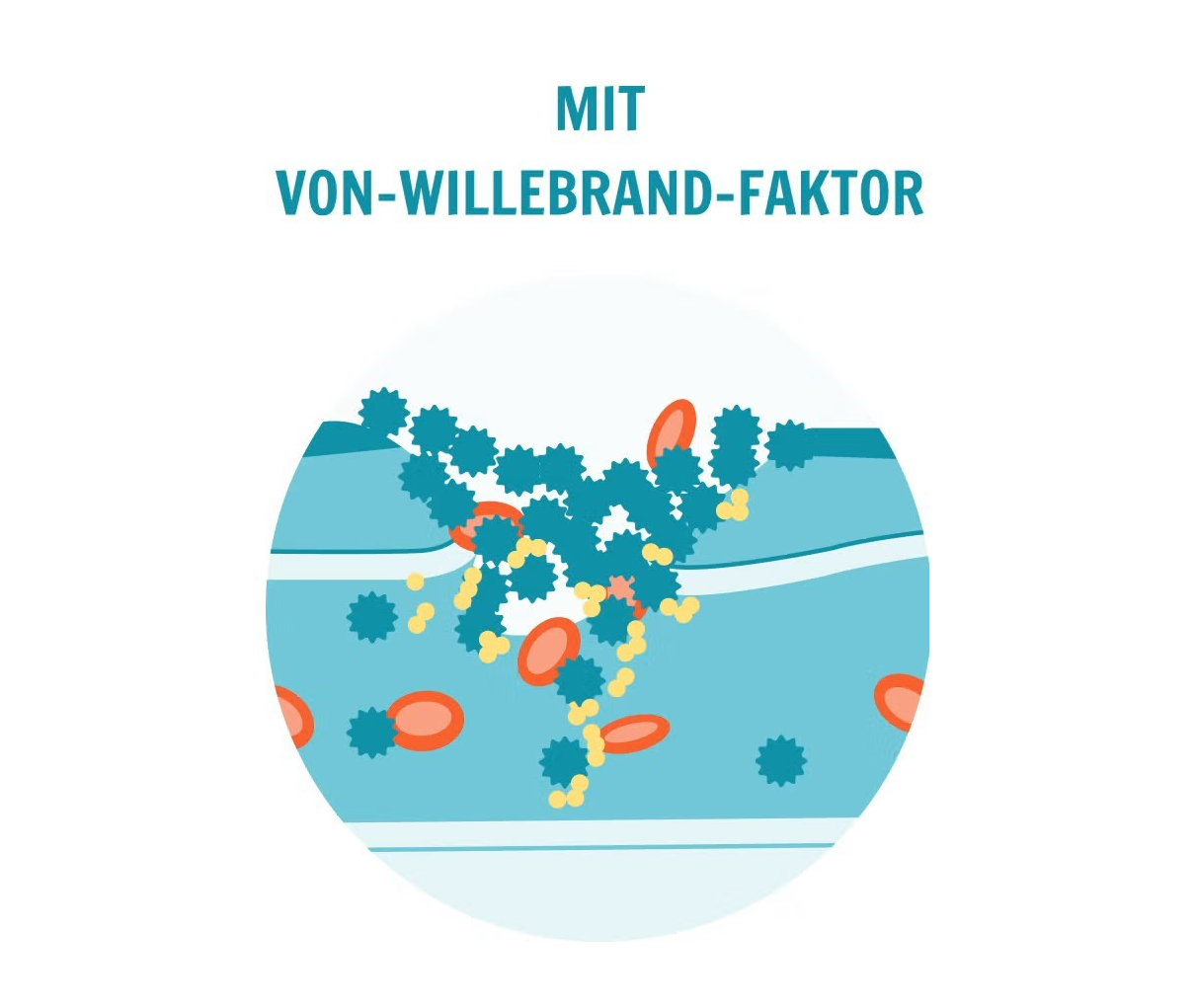 Grafik die Auswirkungen mit Von-Willebrad-Faktor zeigen
