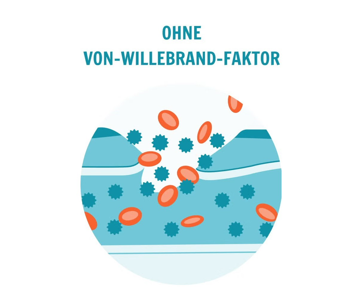 Grafik die Auswirkungen ohne Von-Willebrad-Faktor zeigen