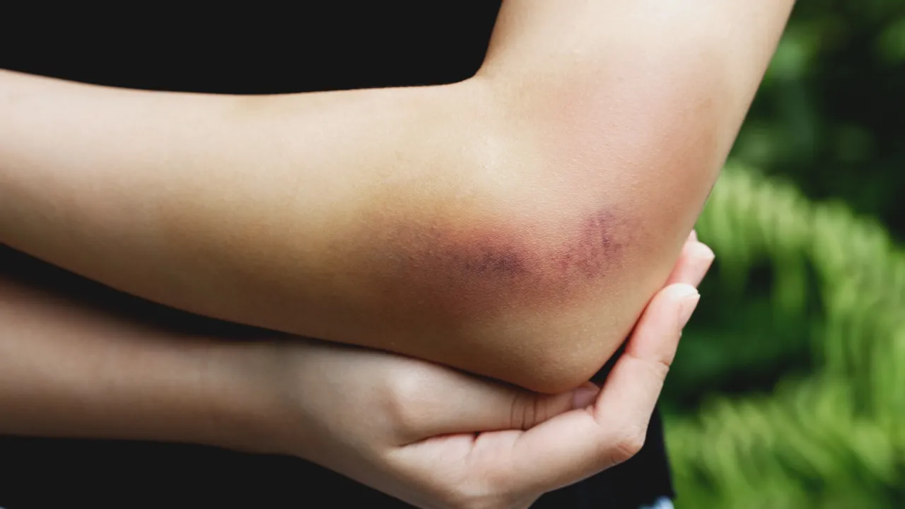 adobestock_215653271