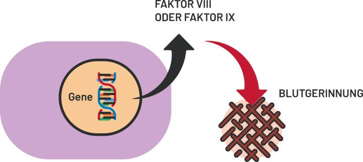 Die Abbildung vergleicht normale und gestörte Blutgerinnung: Links wird bei intakten Genen ausreichend Gerinnungsfaktor VIII oder IX gebildet, wodurch eine normale Blutgerinnung möglich ist. Rechts fehlt infolge eines Gendefekts einer dieser Faktoren, was zu einer minimalen Blutgerinnung führt.
